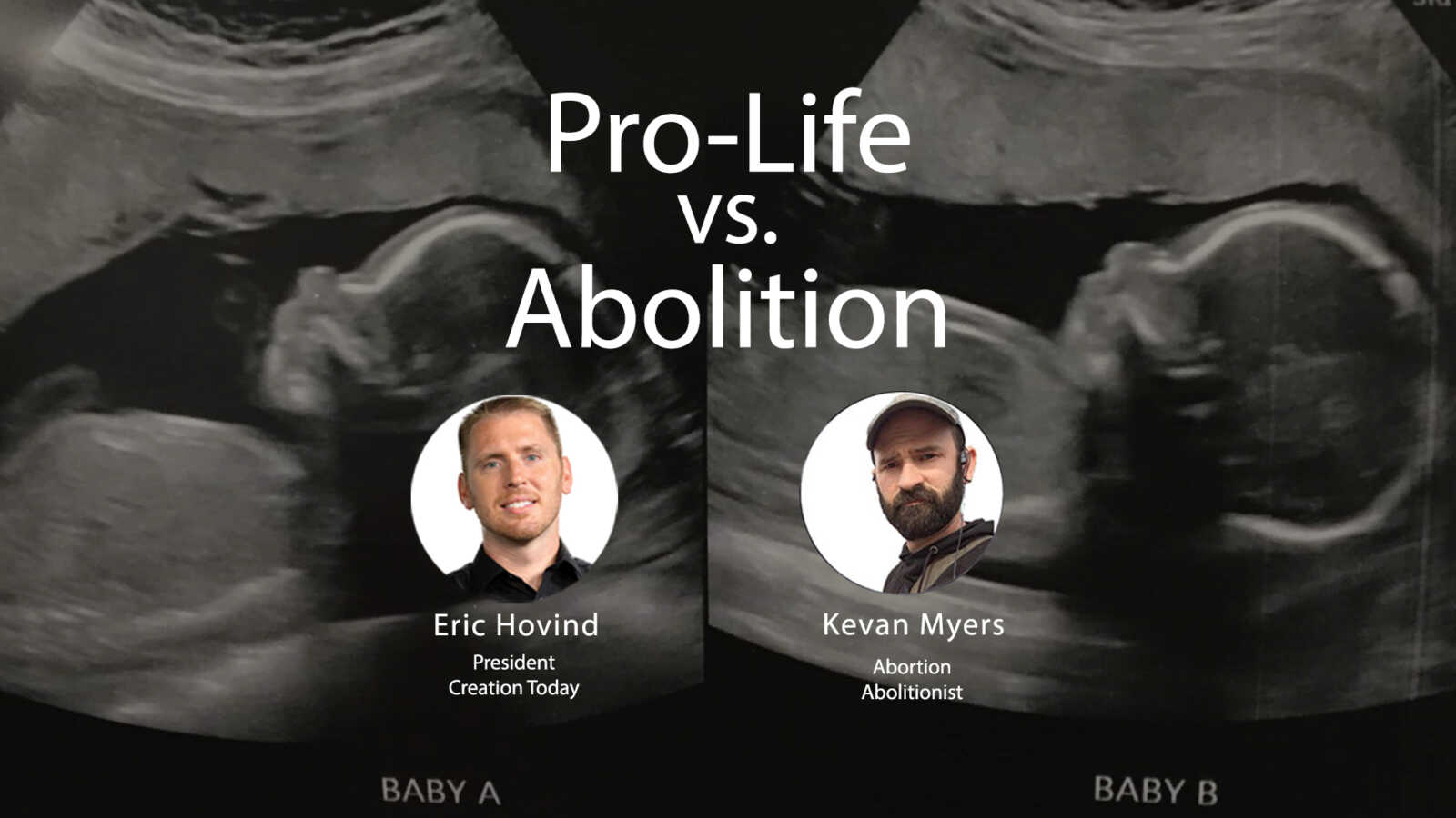 Pro-Life vs Abolition